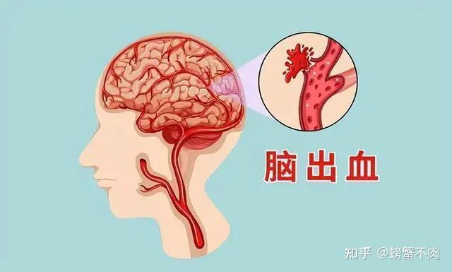 高血压的危害你注意了吗？